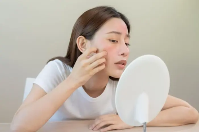 Ikuti Tips Ini untuk Perawatan Kulit Sensitif